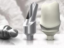 种植&mdash;韩国奥齿泰